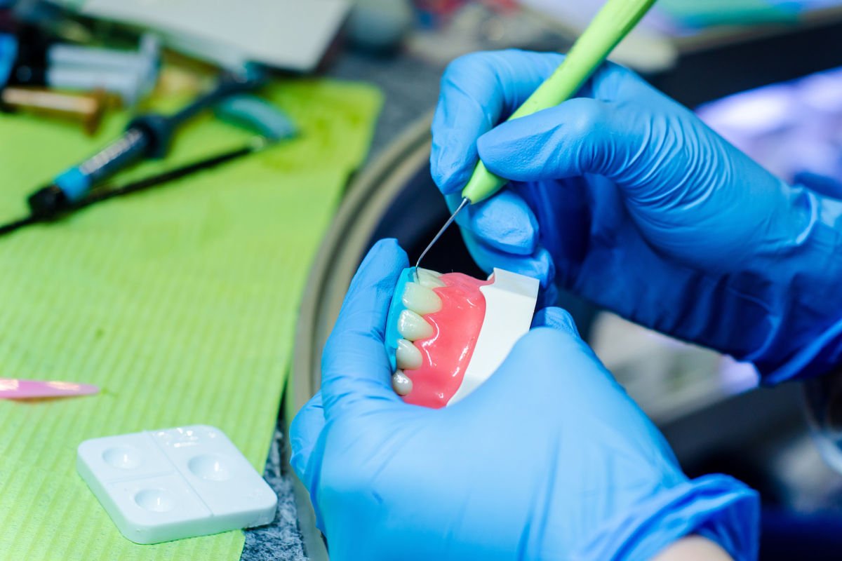 Immediate Dentures at NuBite Denture Clinic in Langley