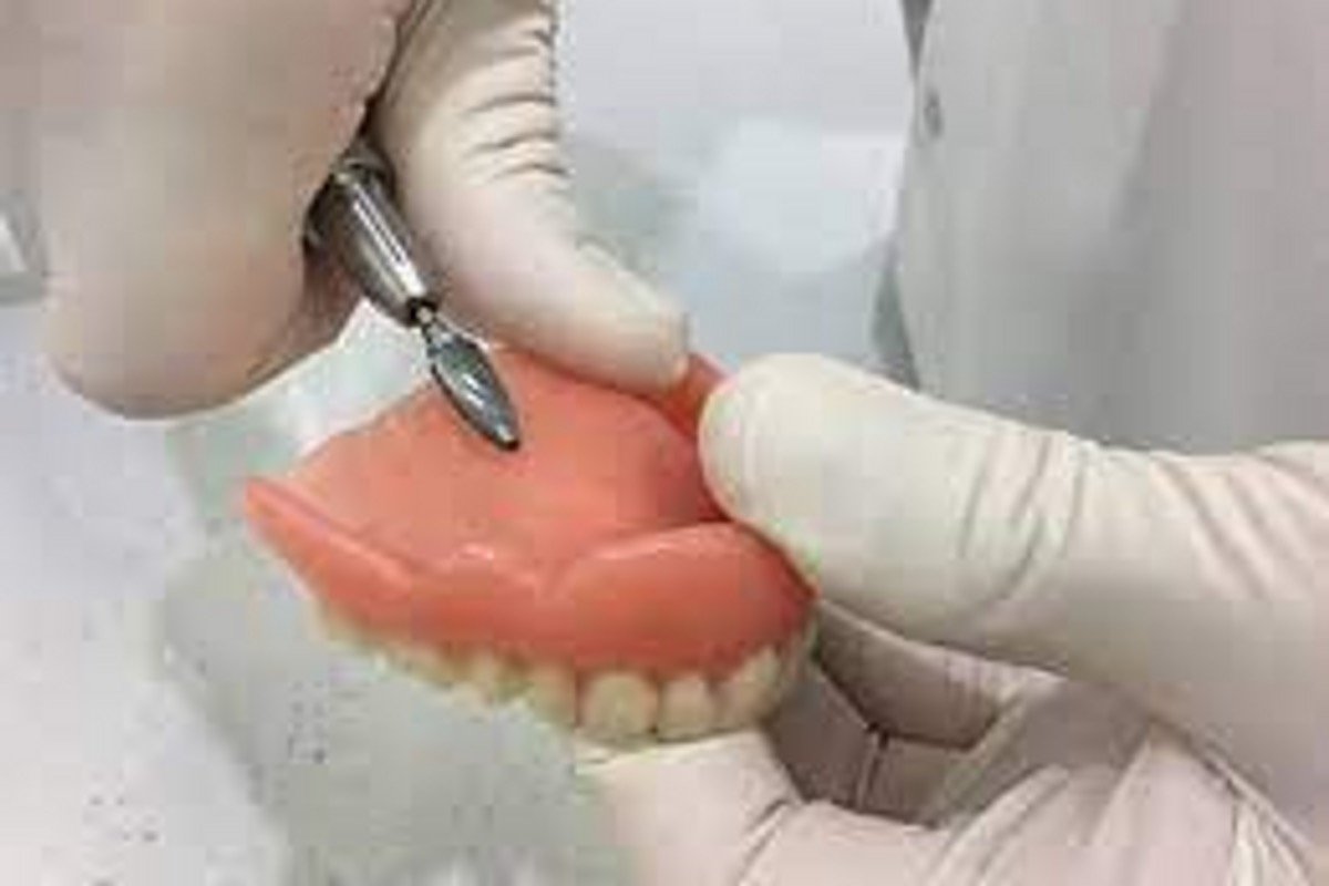 Relines & Rebases at NuBite Denture Clinic in Langley